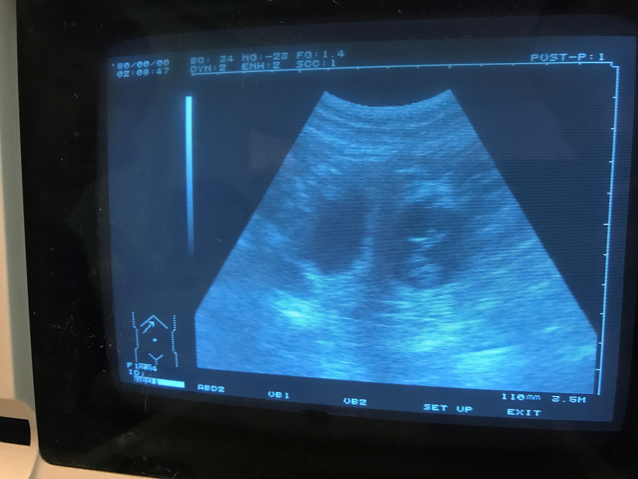 echo-kataum-inua-tipsinartok